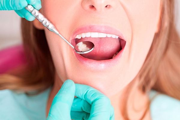 Зубні пломби в Mydentist