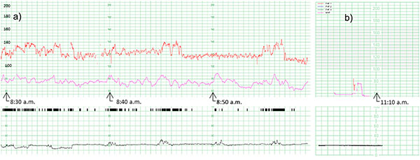 Сучасна кардіотокографія