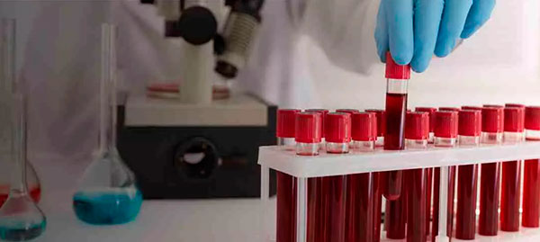 Про що свідчить загальний аналіз крові: як не панікувати через цифри
